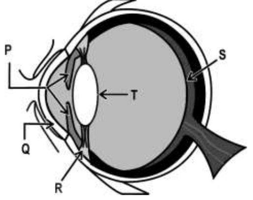 Figure from the question paper for: (a) Rupal suffers from myopia. Where would the image form in her eye? (b) Name the type of